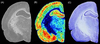 Developmental Changes of Glutamate and GABA Receptor Densities in Wistar Rats